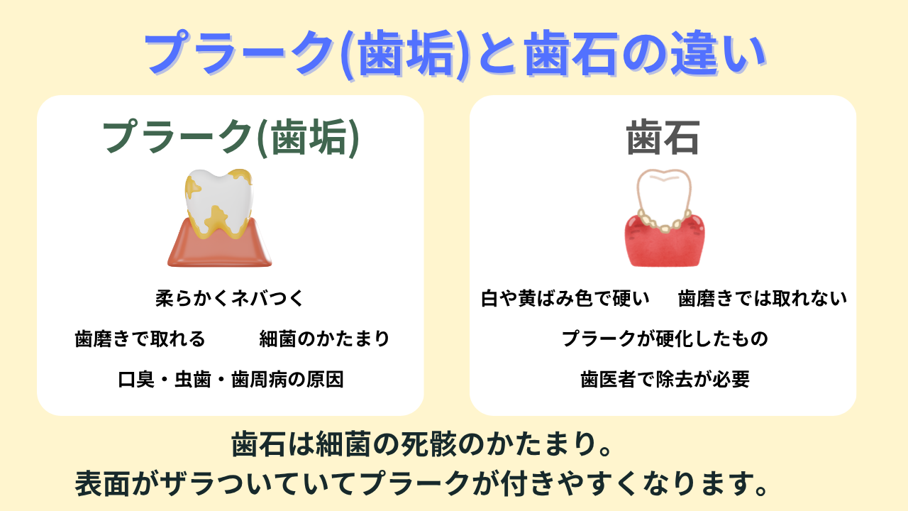 歯磨きでプラーク（歯垢）を除去する方法｜歯石も取れるかを解説｜江戸川区一之江駅前の歯医者｜⼀之江駅前イルニード⻭科