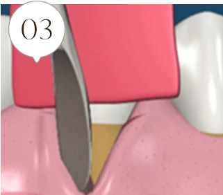 03
