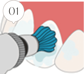 01